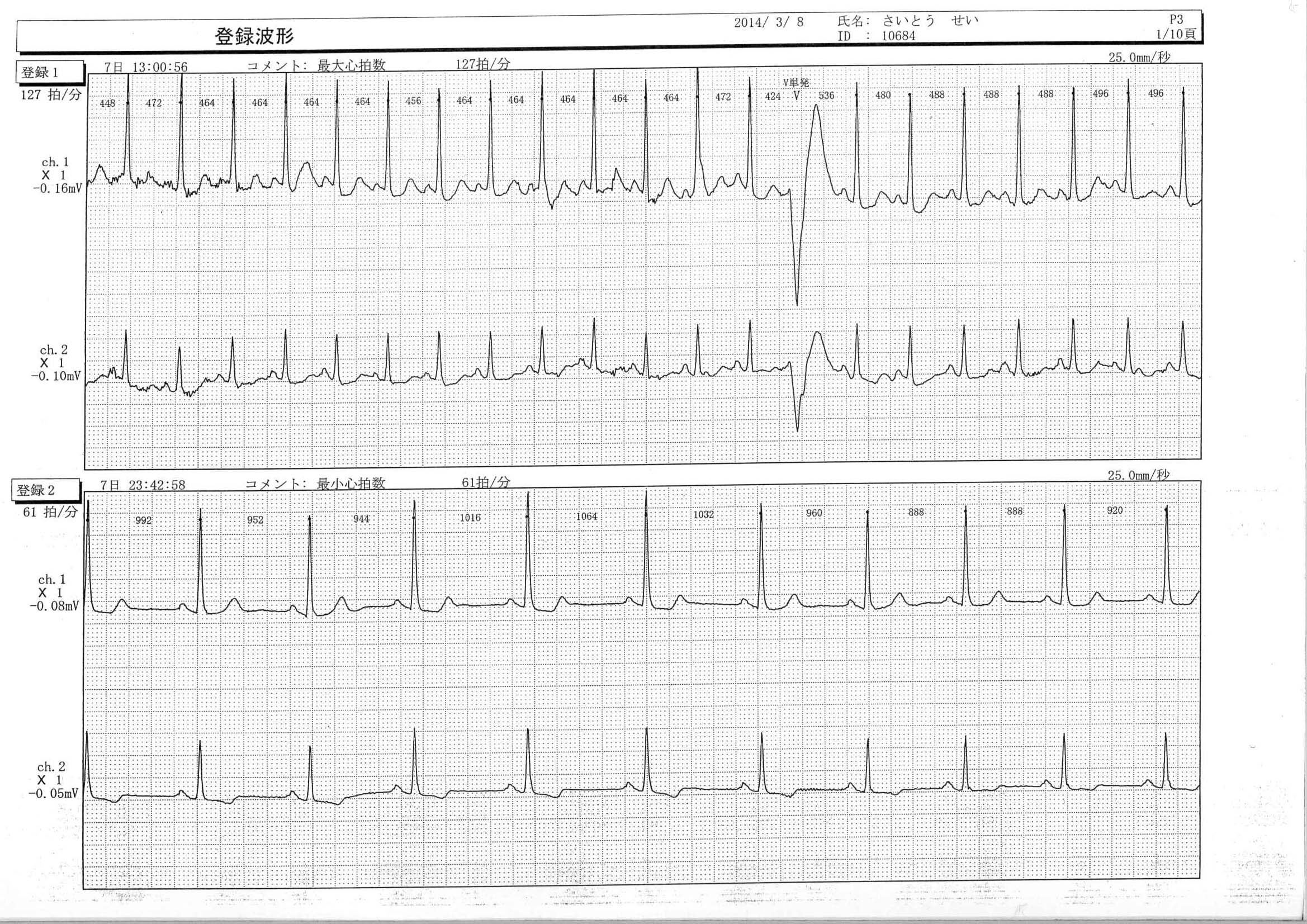 心拍数・脈拍 のコピー